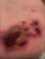 Rane na stomaku Leposave Bajković