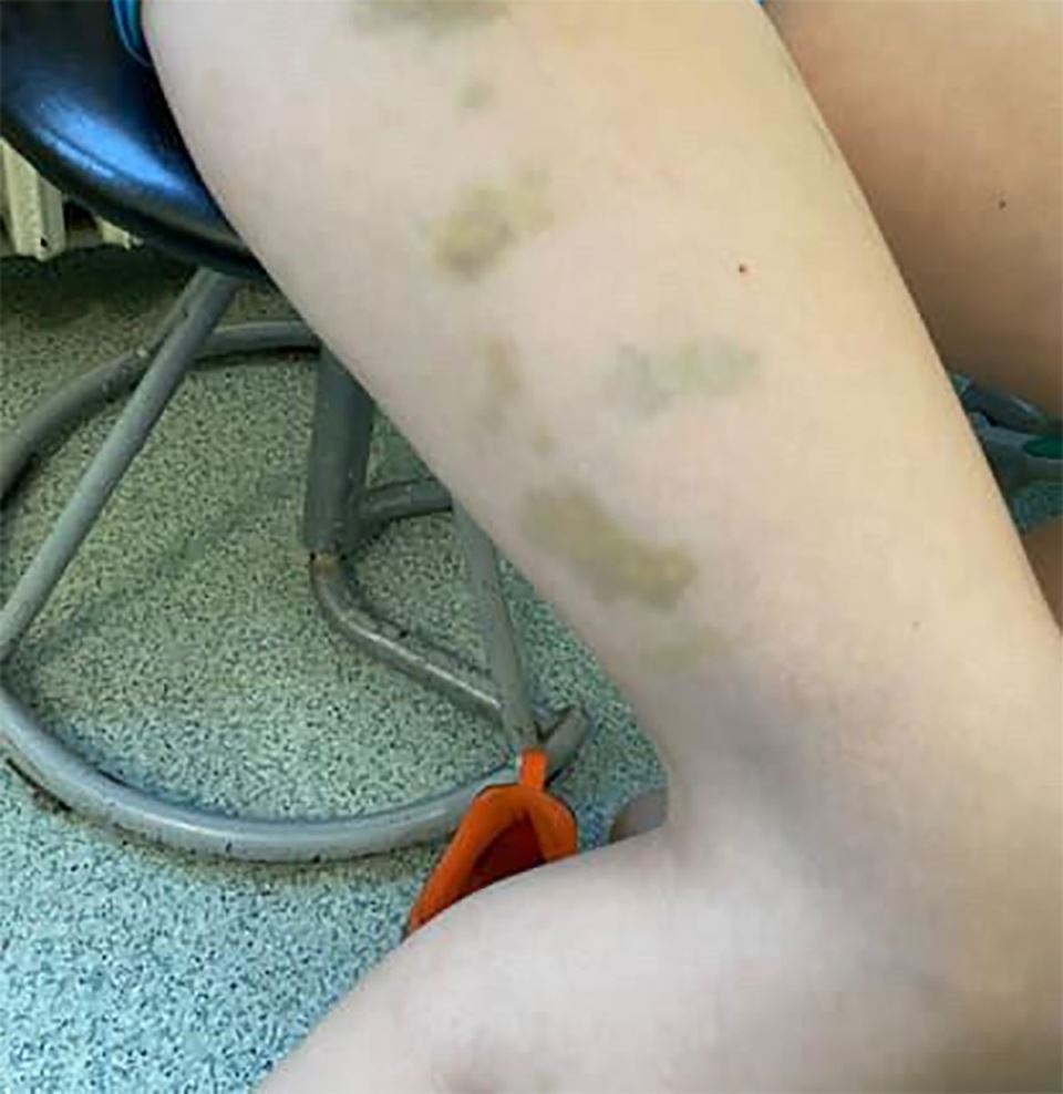 Vršnjak pretukao dečaka (3).jpg