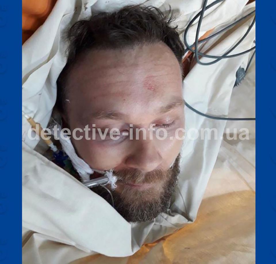 fotografije Radoja Zvicera nakon pokušaja atentata