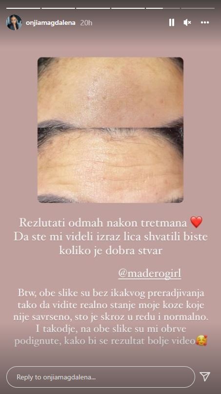 Onjia Magdalena objasnila je ceo postupak na svojim storijima.