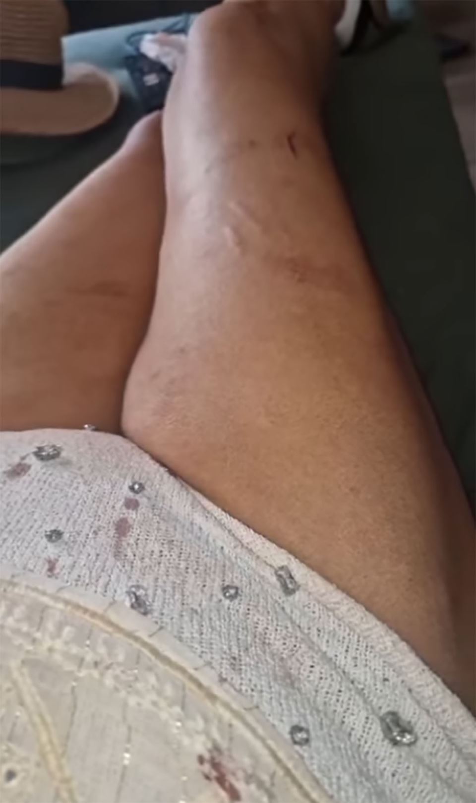 Ana Nikolić pretučena (1).jpg