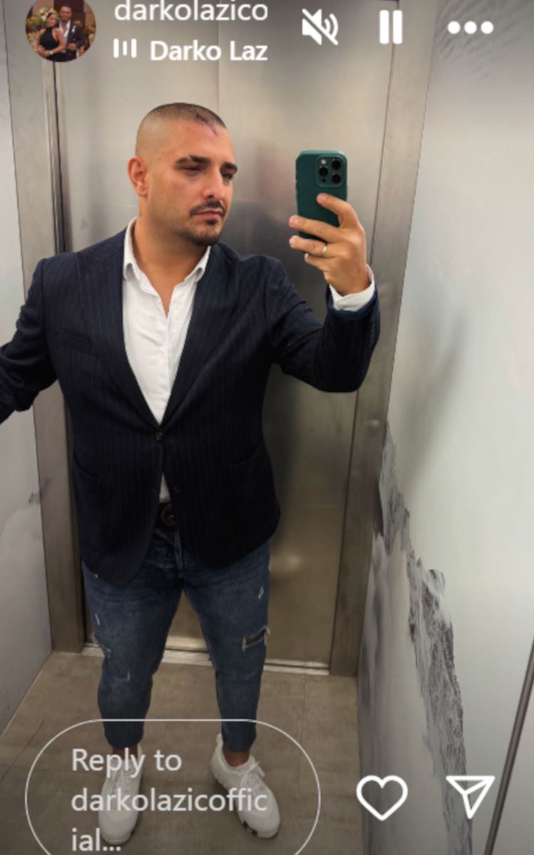 Darko Lazić psole udesa rana.jpg