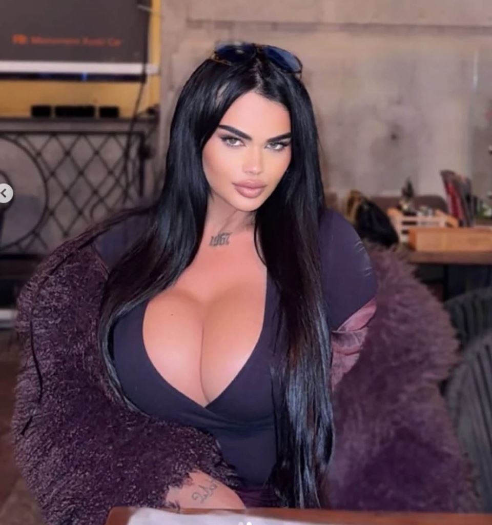 Transrodnoj Kiki hirurg spojio grudi (2).jpg