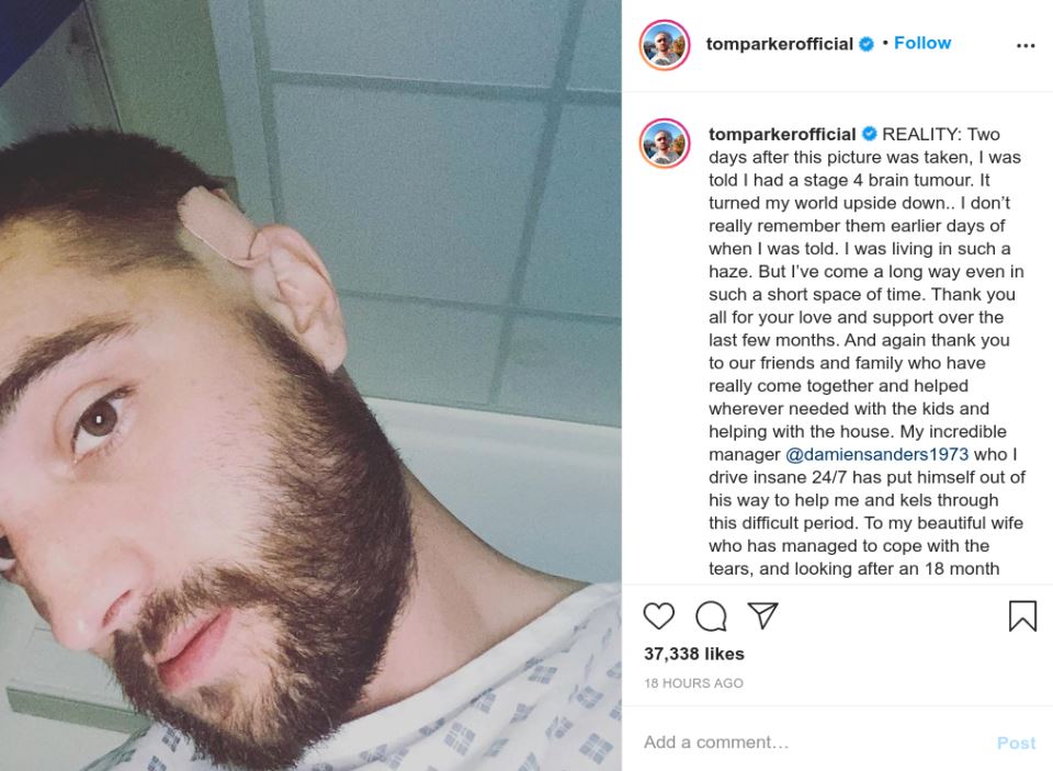 tom parker the wanted tumor na mozgu instagram foto