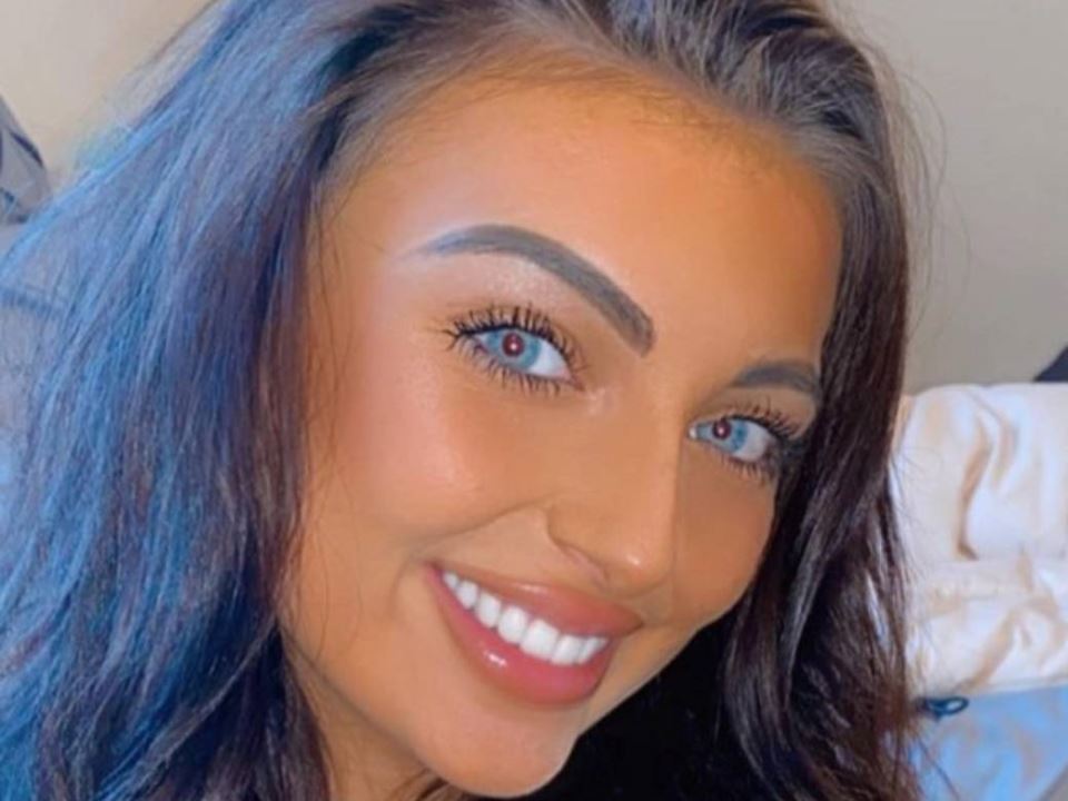 funkcionalni neuroloski poremecaj simptomi tiktok