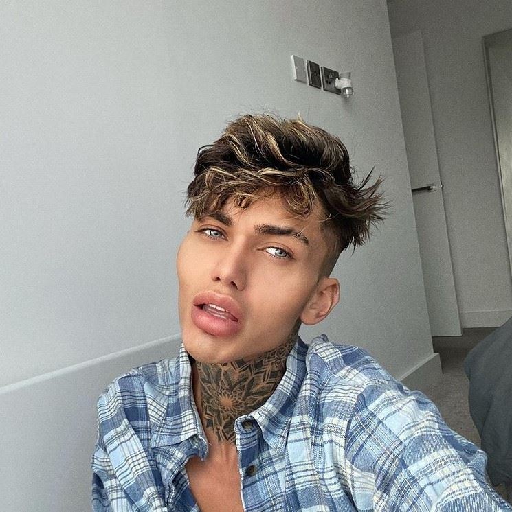 muskarci plasticne operacij instagram filter levi jed murphy