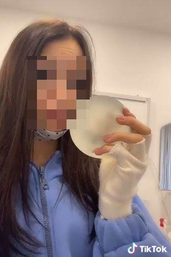 maloletna influenserka ugradila silikone sestra sare damnjanovic