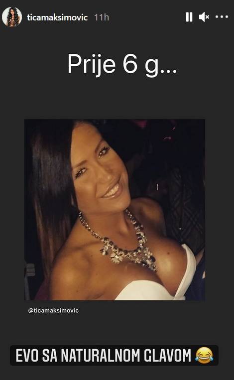 tijana ajfon plasticne operacije botoks video