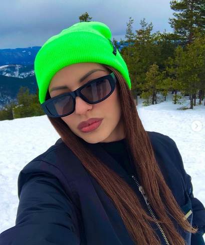 zvezdana stevanovic zadruga pre i posle foto