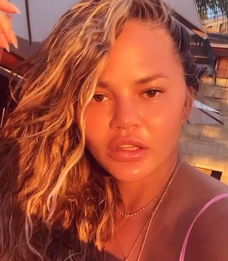 alergija na voce usne fotografije krisi tejgen