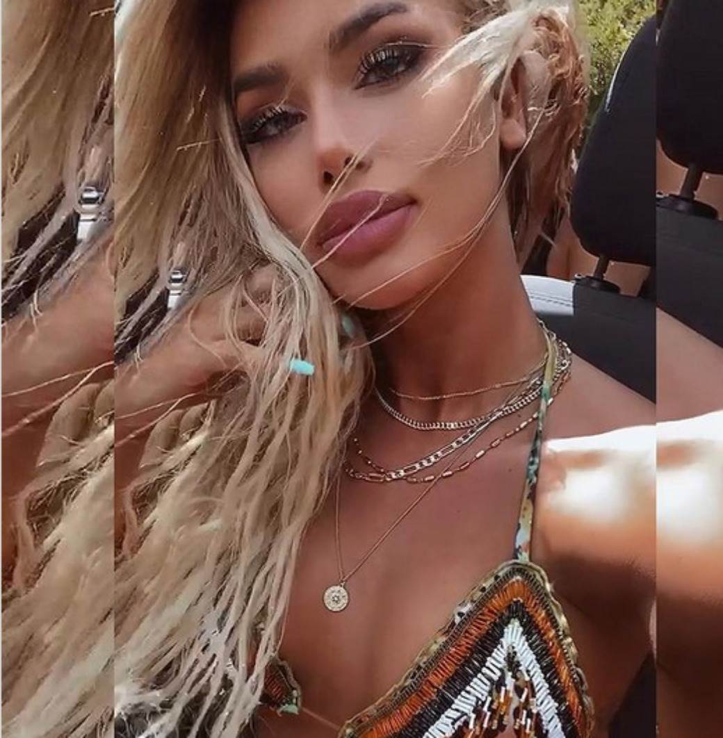 Ivana Nikolić o privatnom životu i operacijama