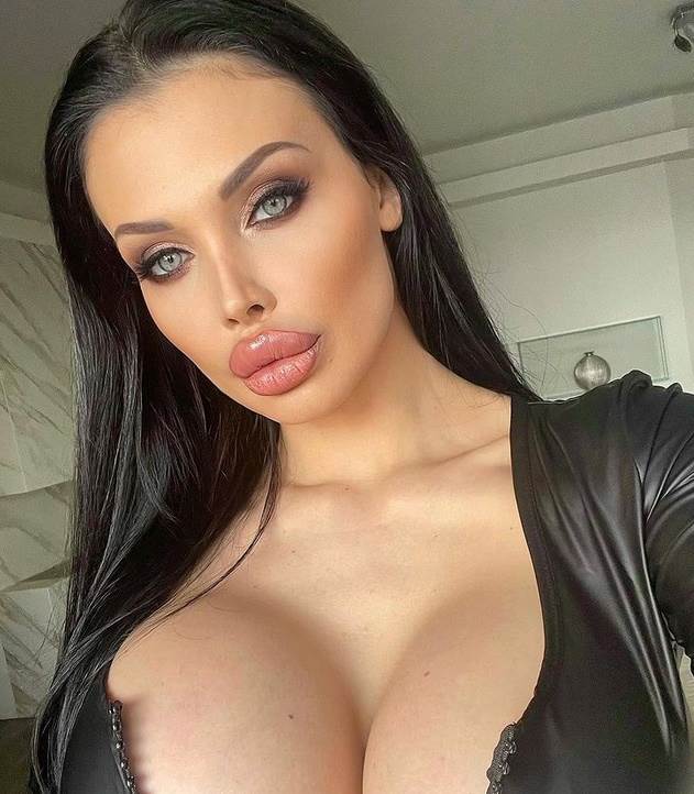 aleta ousn silikoni foto