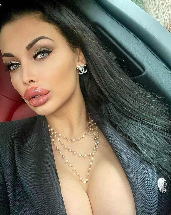 aleta ousn silikoni foto