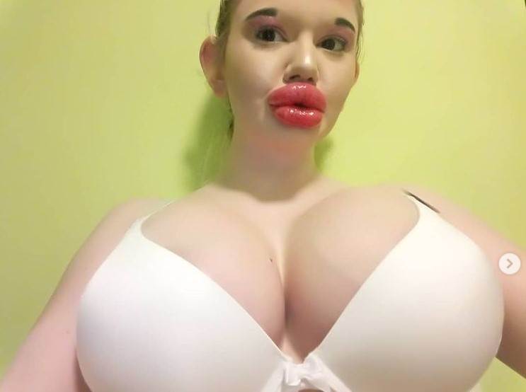 Andrea Ivanova plastične operacije