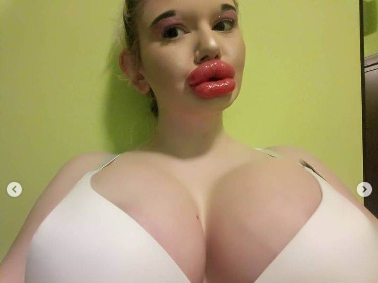 Andrea Ivanova plastične operacije