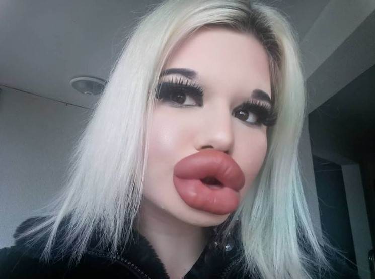 Andrea Ivanova plastične operacije