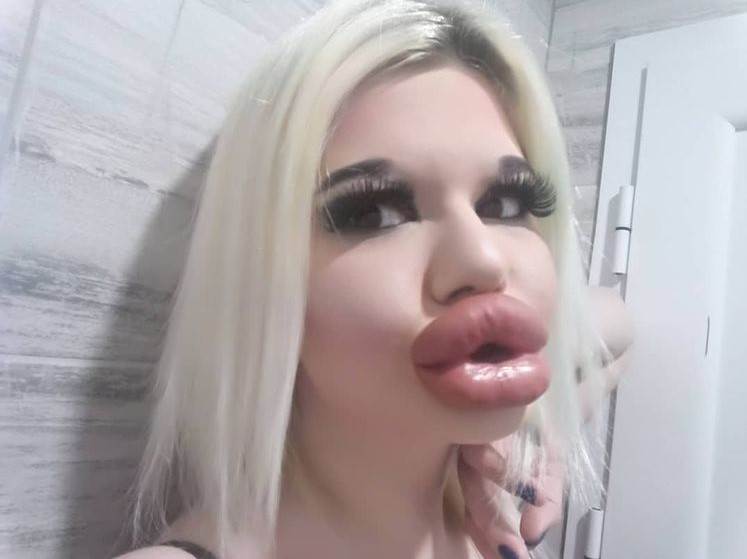 Andrea Ivanova plastične operacije