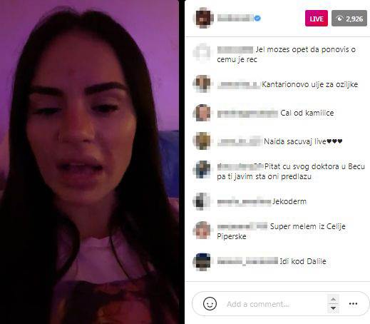 kozmeticki salon beograd opekotine na kozi naida gadzo instagram uzivo