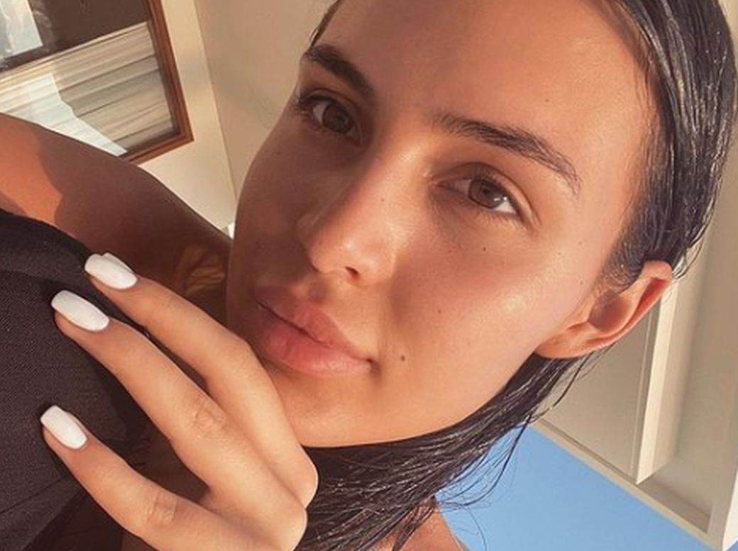 Anastasija Ražnatović pre operacija