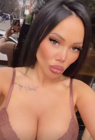 tamara djuric plasticne operacije kako je izgledala pre foto