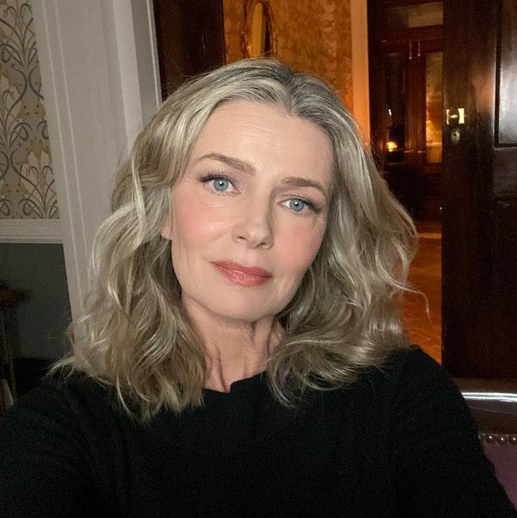 plazmapen posledice oziljci na kozi model paulina porizkov fotografije