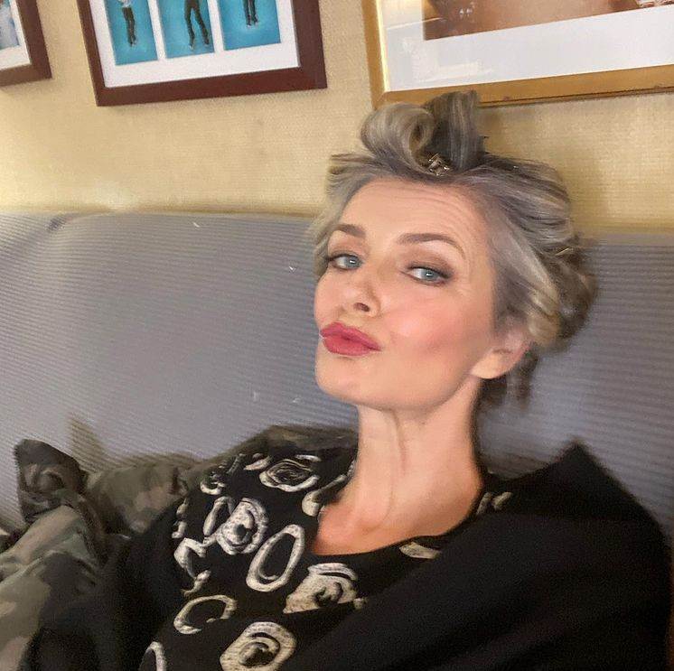 plazmapen posledice oziljci na kozi model paulina porizkov fotografije