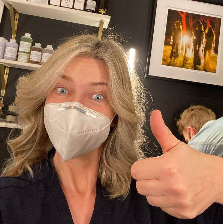 plazmapen posledice oziljci na kozi model paulina porizkov fotografije