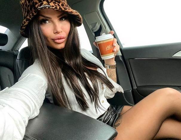 Marija Ana Smiljanić pre i posle plastičnih operacija