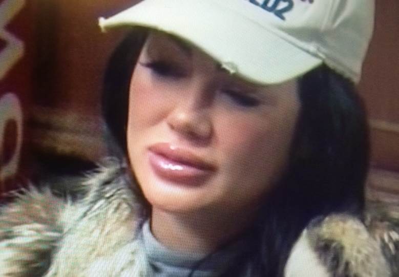 Tamara Đurić toples posle operacije