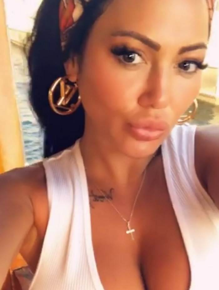 Tamara Đurić toples posle operacije