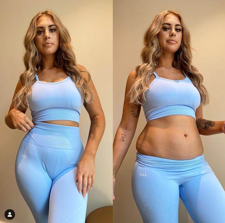 realan izgled zenskog tela celulit ariella nyssa instagram