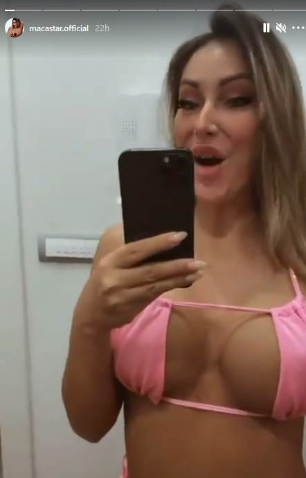 Maca Diskrecija pre plastičnih operacija