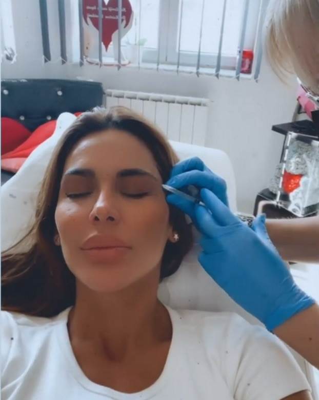 marina viskovic plasticne operacije botoks video