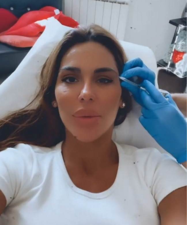 marina viskovic plasticne operacije botoks video