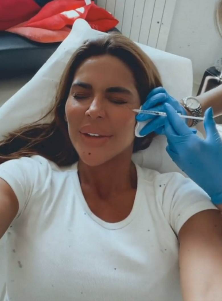 marina viskovic plasticne operacije botoks video