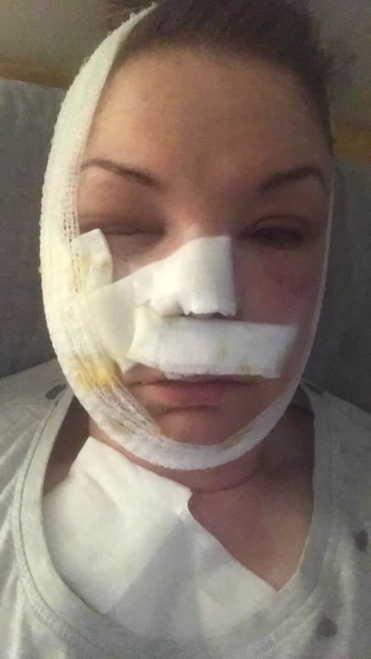 jaja iz mikrotalasne eksplozija opasnost