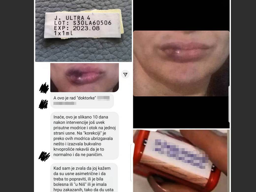 uhapsena beogradska nadrilekarka slala pretnje zrtvama fotografije