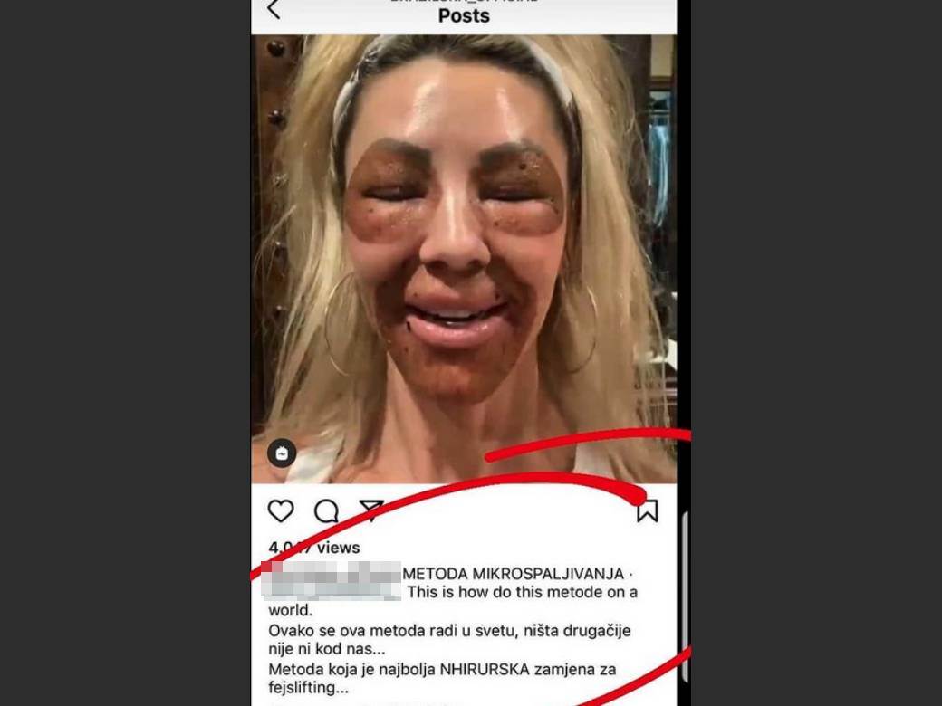 uhapsena olgica markanovic nadrilekarstvo ispovest zrtva