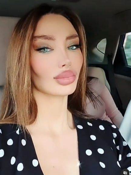 Soraja nosi narukvicu od 20.000 evra