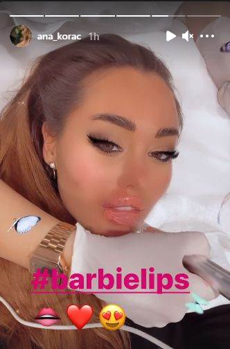 ana korac plasticne operacije nova usta doradila se