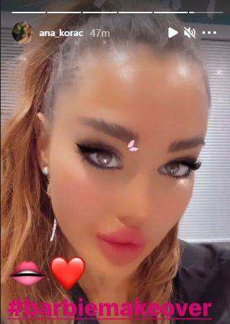 ana korac plasticne operacije nova usta doradila se