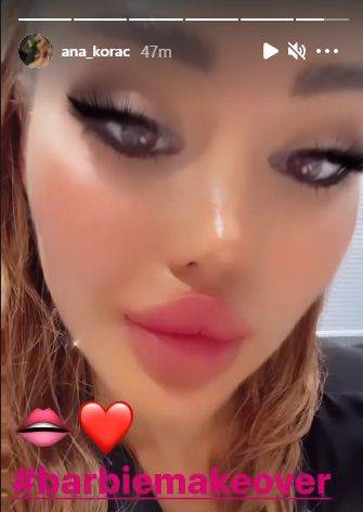 ana korac plasticne operacije nova usta doradila se