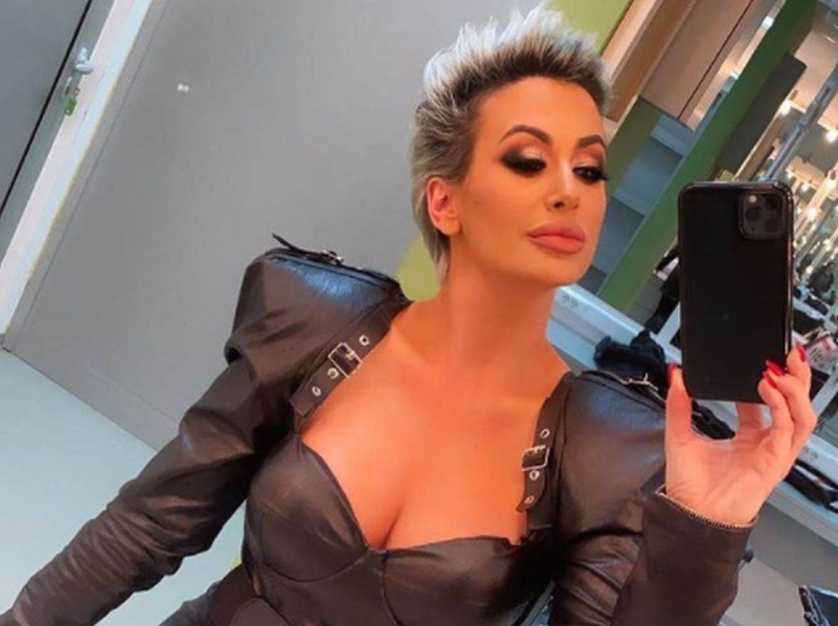 Dušica Jakovljević pokazala masnice na ruci