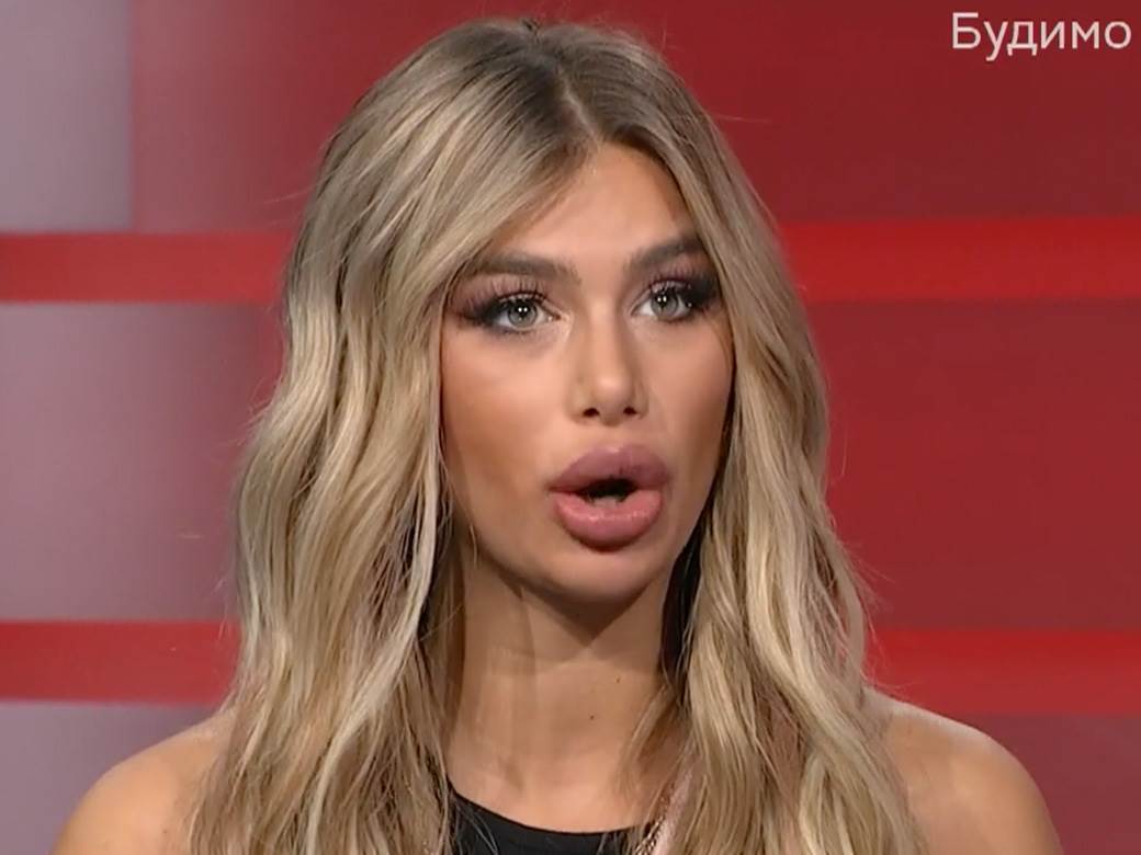 Ivana Nikolić o privatnom životu i operacijama