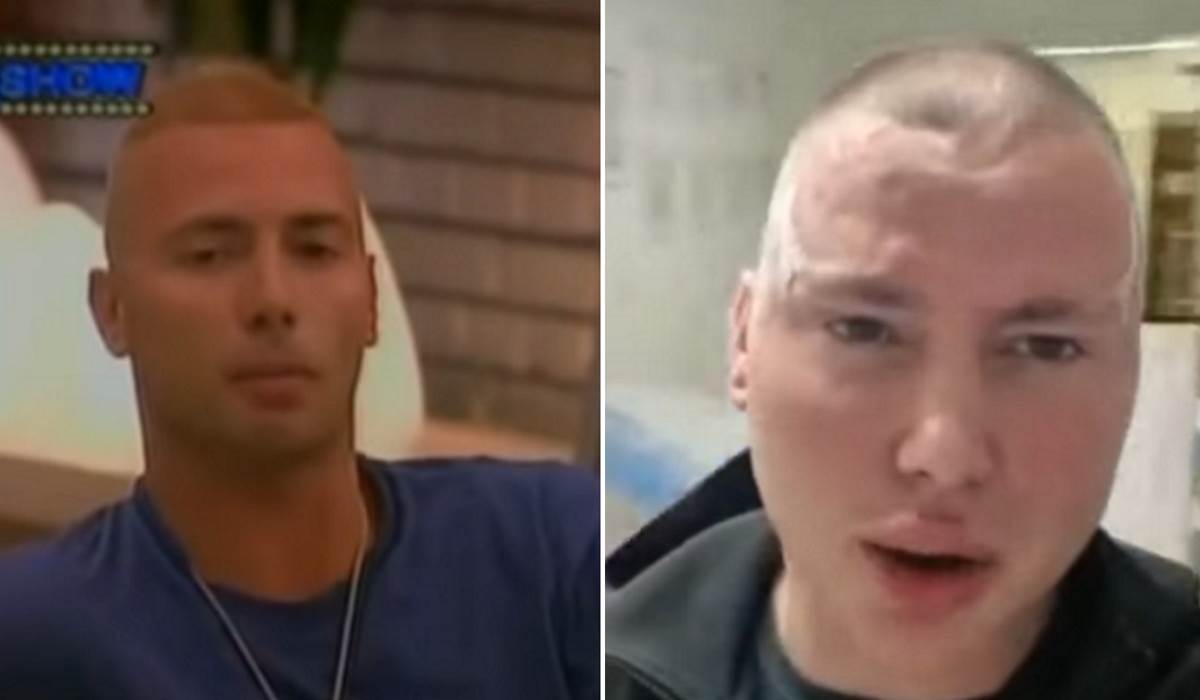 "Doktori su me upropastili, samo hoće novac": Brendon progovorio o operacijama, za par godina postao drugi čovek